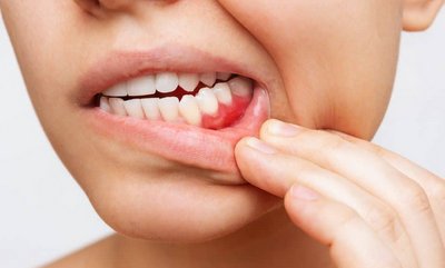 best dentists for wisdom teeth removal in Gujarat
