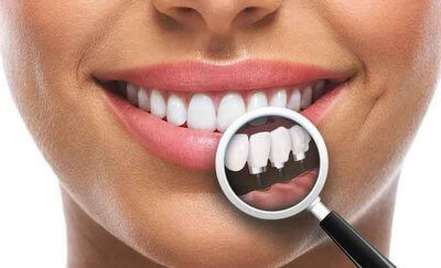 Full Mouth dental implants in Gujarat