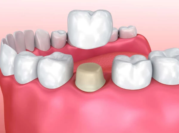 Best Dental Hospital in Gujarat