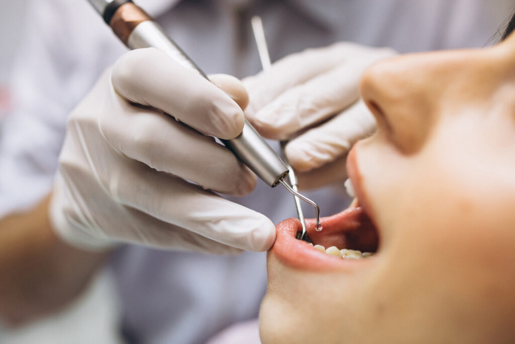 Dental Implants best option for replacing teeth