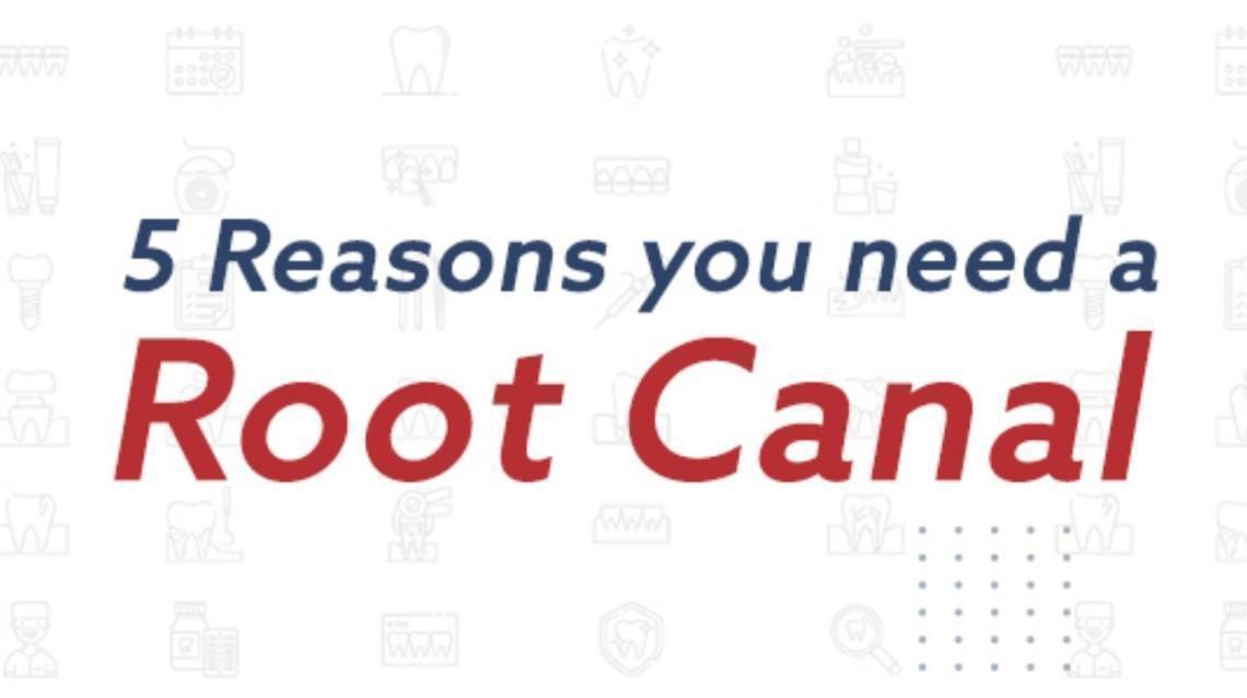 5 Reasons You Need Root Canal Treatment