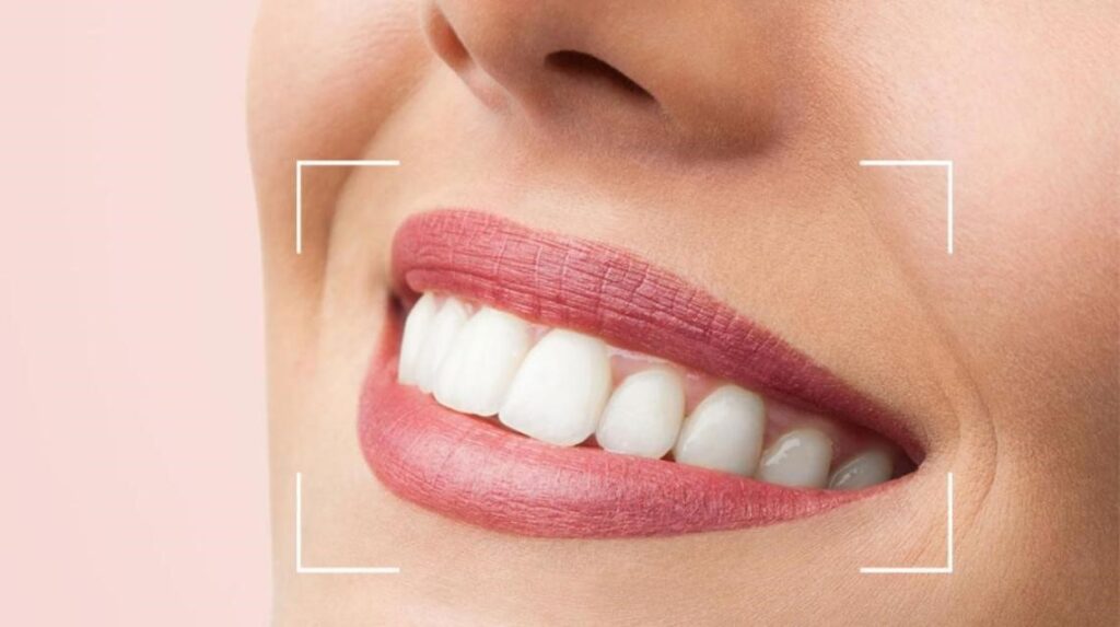 Digital Smile Design