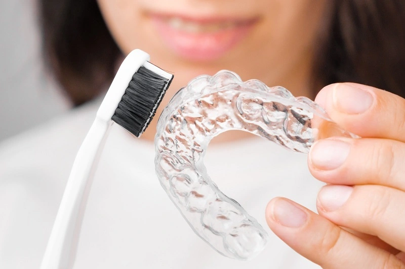 Brushing with Clear Aligners - The Most Convenient Teeth Straightening Treatment