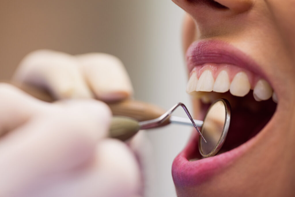 Oral health check up