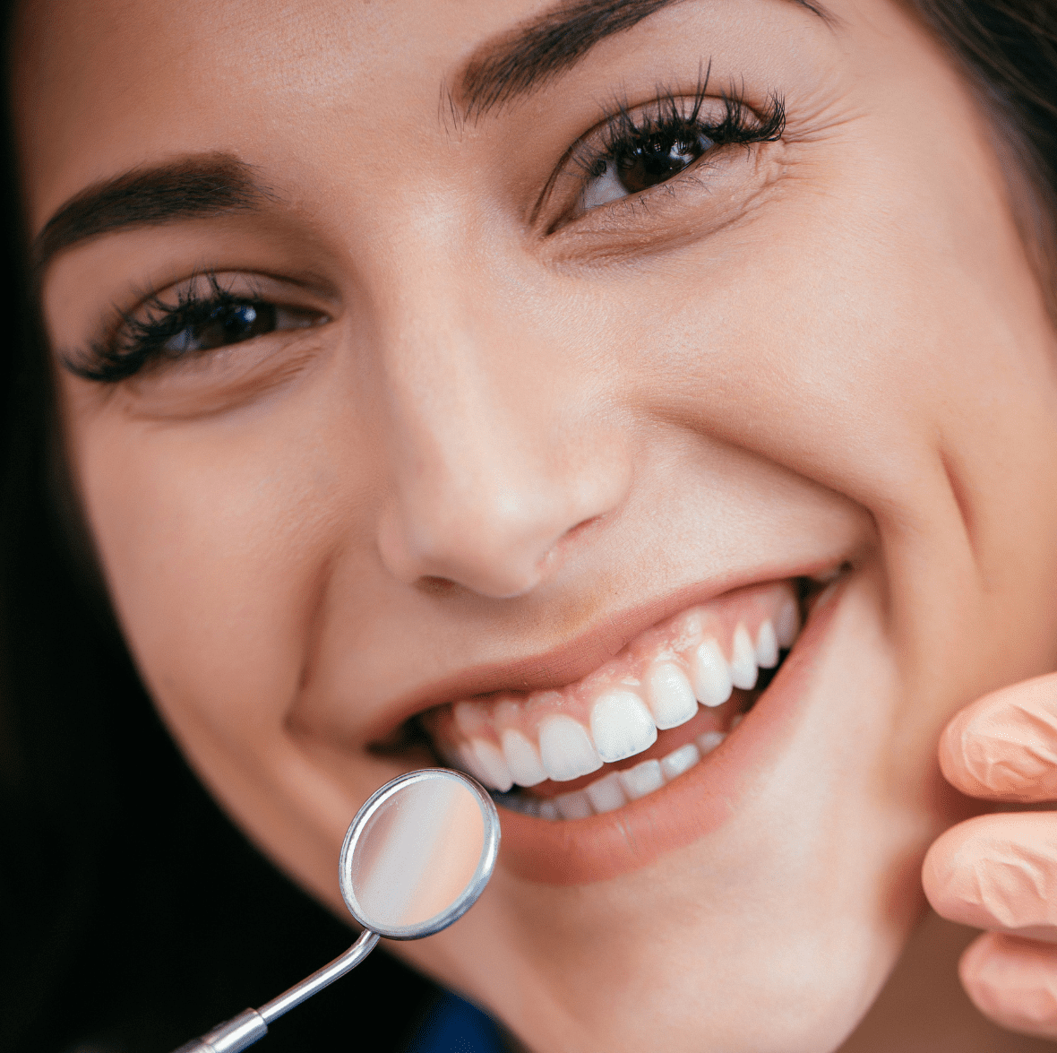 Best Dental veneers in south gujarat