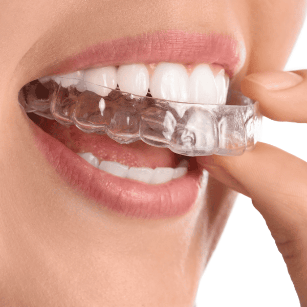Clean Aligners-3