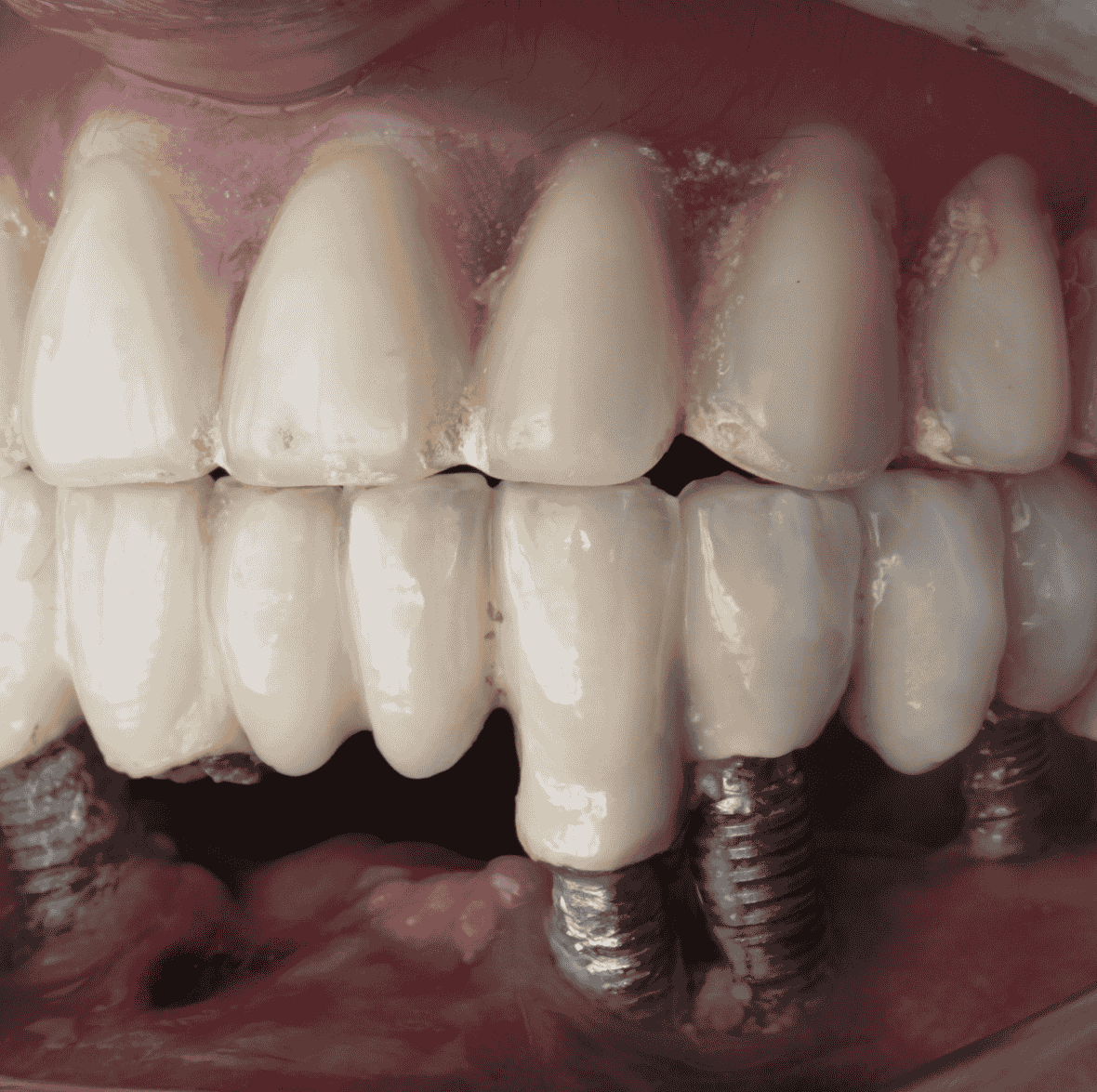 Dental Emergencies-1