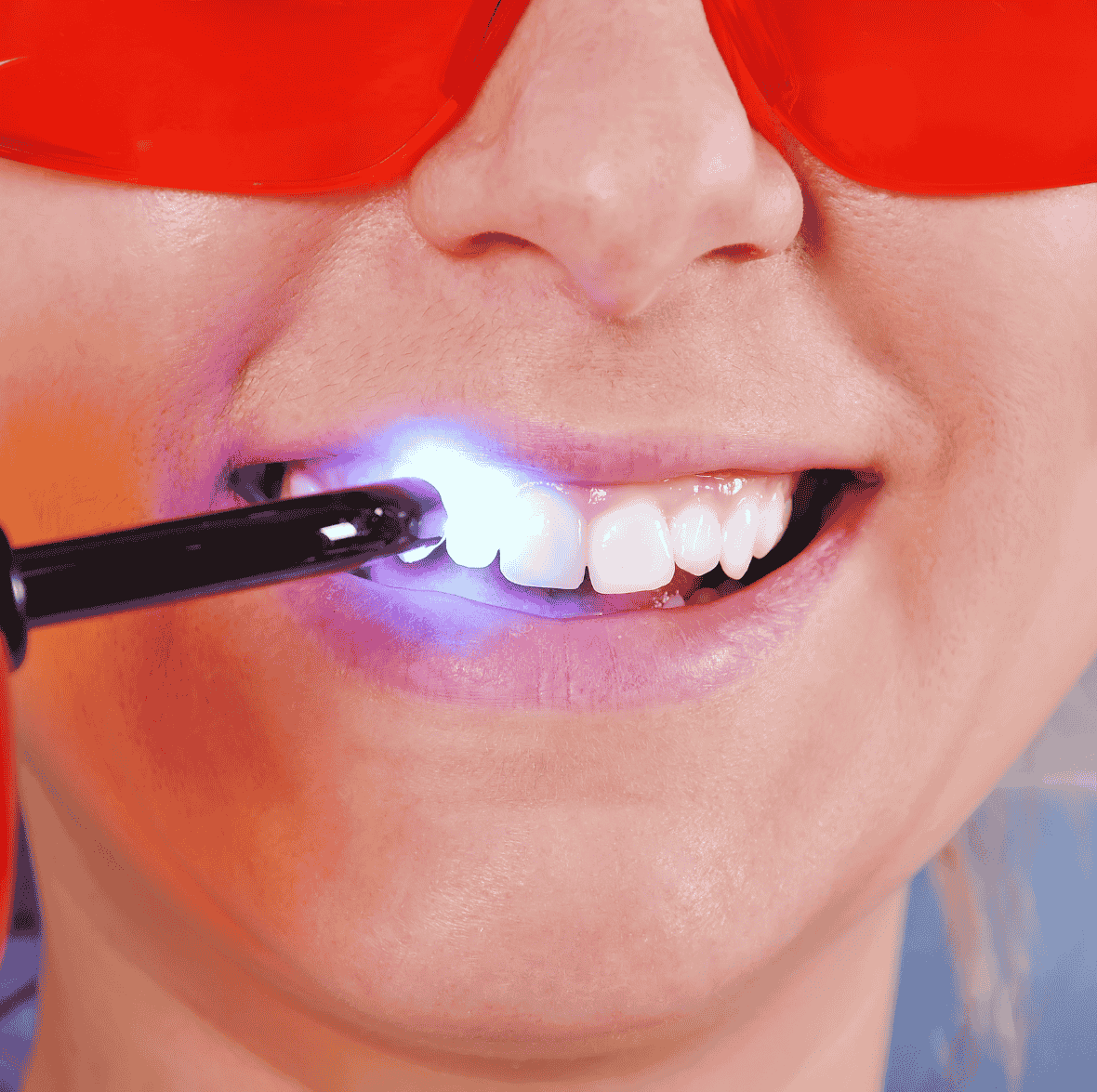 Expert Laser-Dentistry in surat