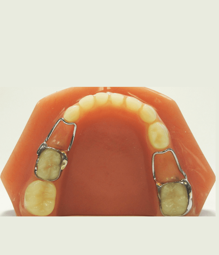 Space maintainers for children