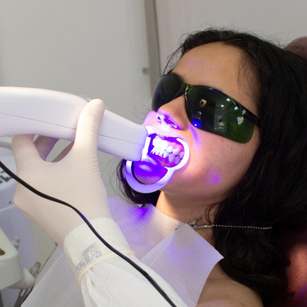 Teeth Whitening in Surat