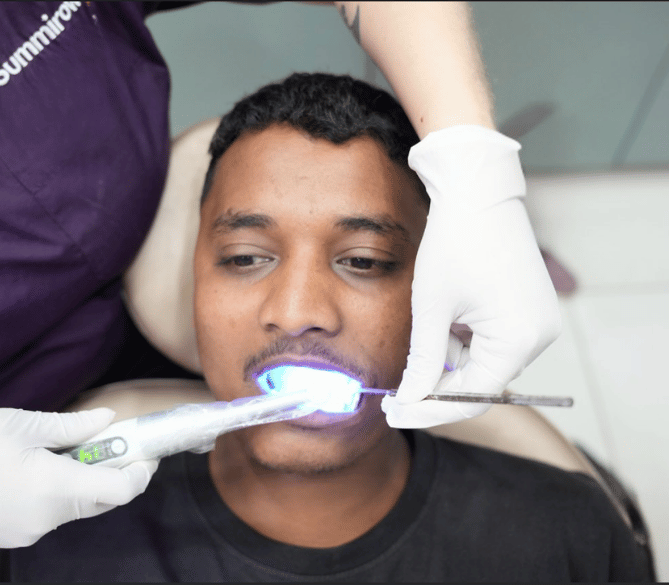 Top Teeth Whitening Treatment in Surat