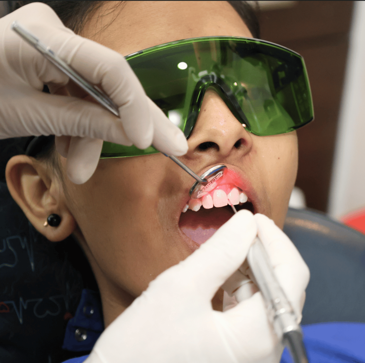 Top laser dentistry in Surat