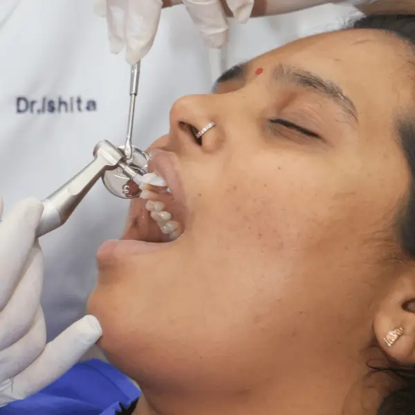 affordable dental scaling and polishing in Surat