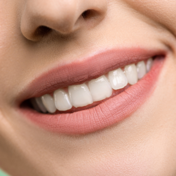 laser teeth whitening surat