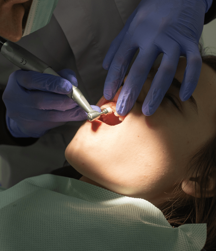 pediatric tooth extraction-1