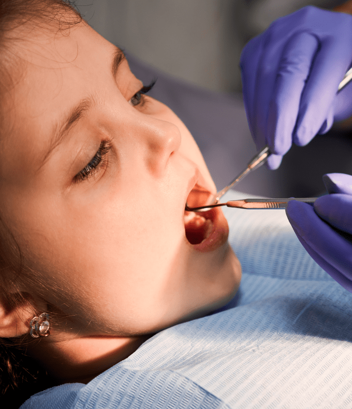 pediatric tooth extraction-3