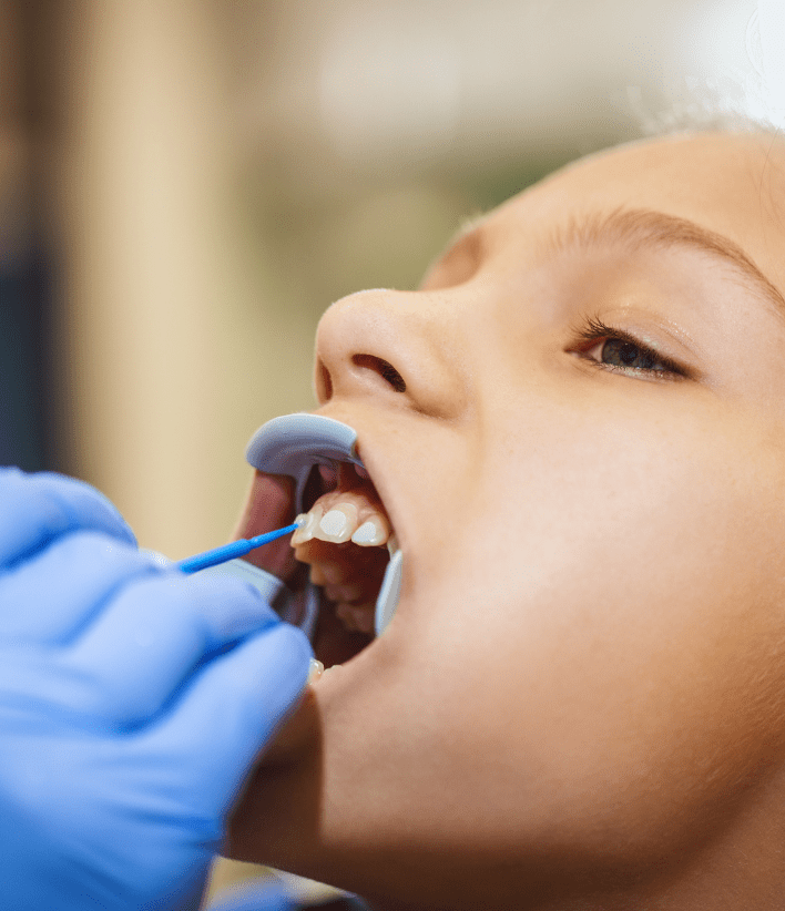 pediatric tooth extraction