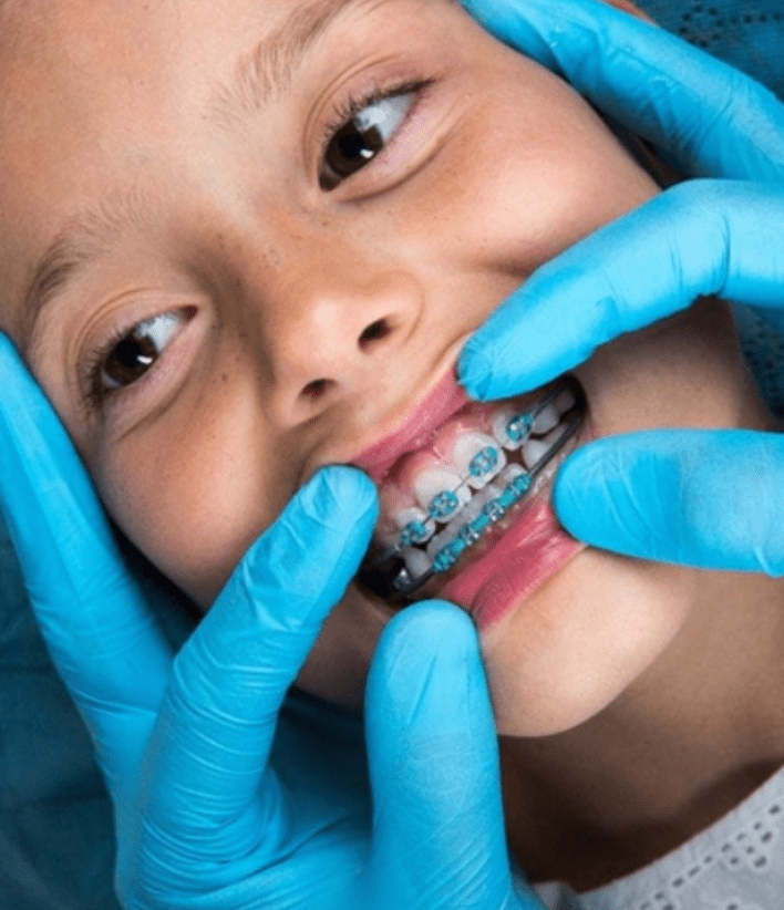 pedo orthodontics - 1