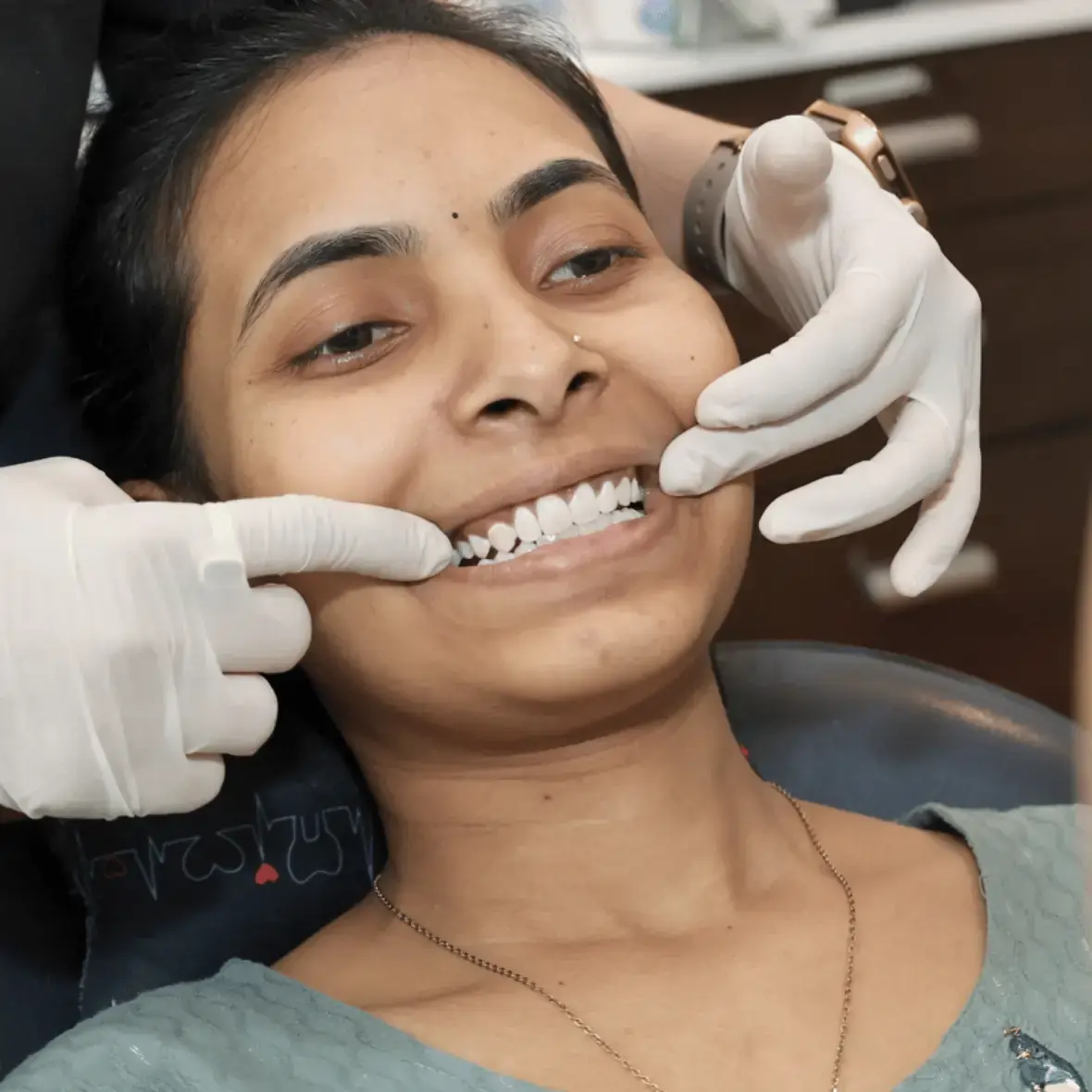 Best Smile Makeover in Surat