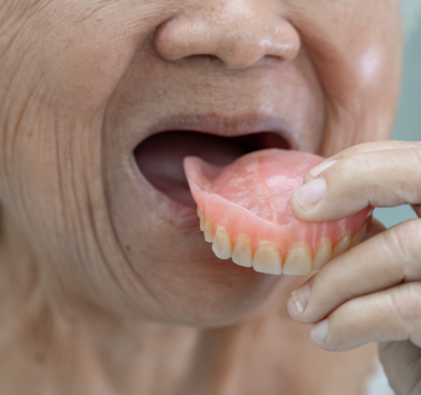 Full Mouth Rehabilitation