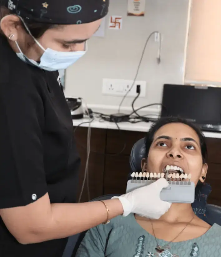 Perfect Smile Makeover in Surat