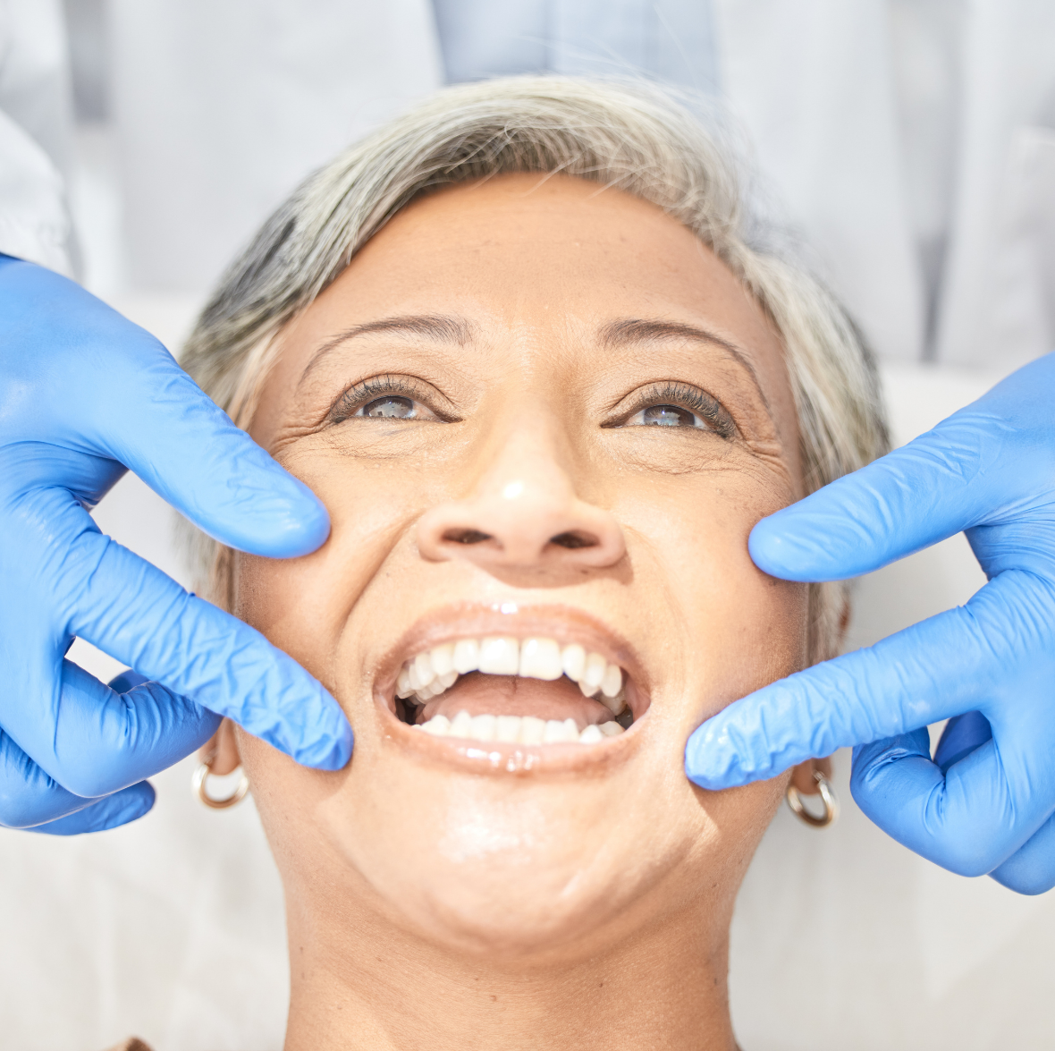 full mouth rehabilitation (1)