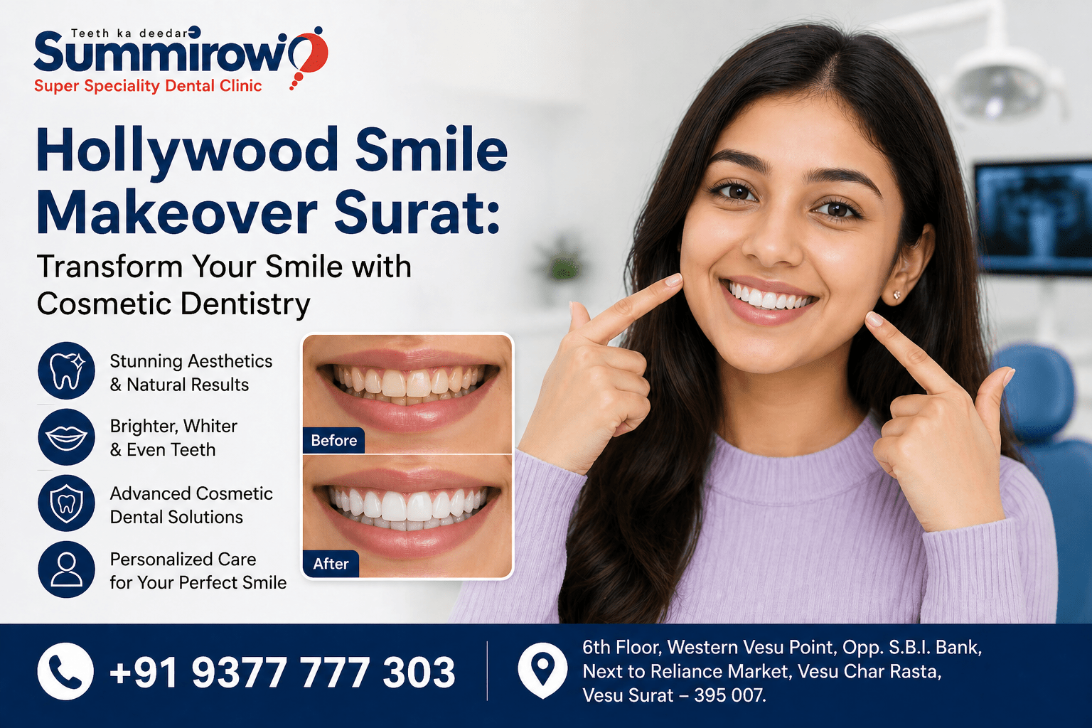 Hollywood Smile Makeover in Surat