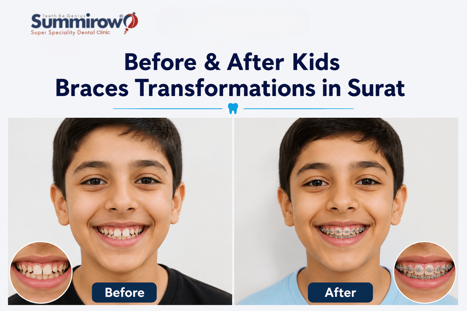 Braces Clinic in Surat