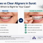 braces vs clear aligner Surat