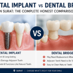 dental implant vs bridge Surat
