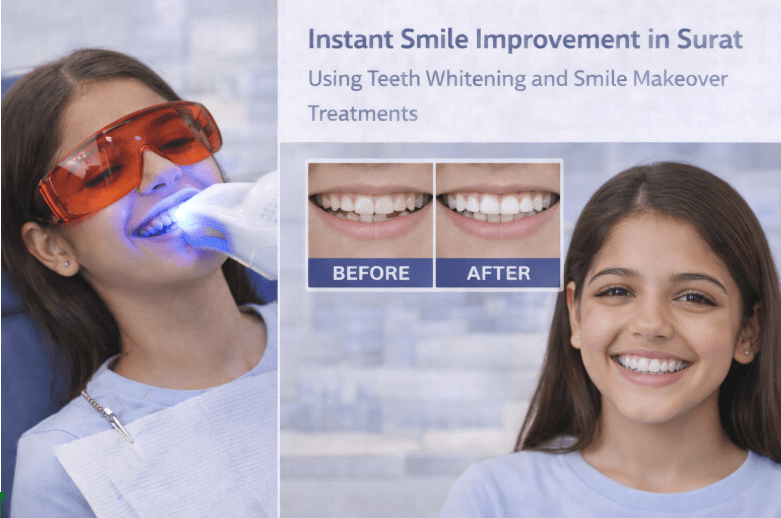 instant smile improvement Surat