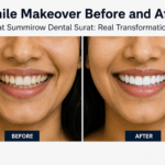 smile makeover before after Surat