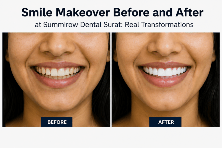 smile makeover before after Surat