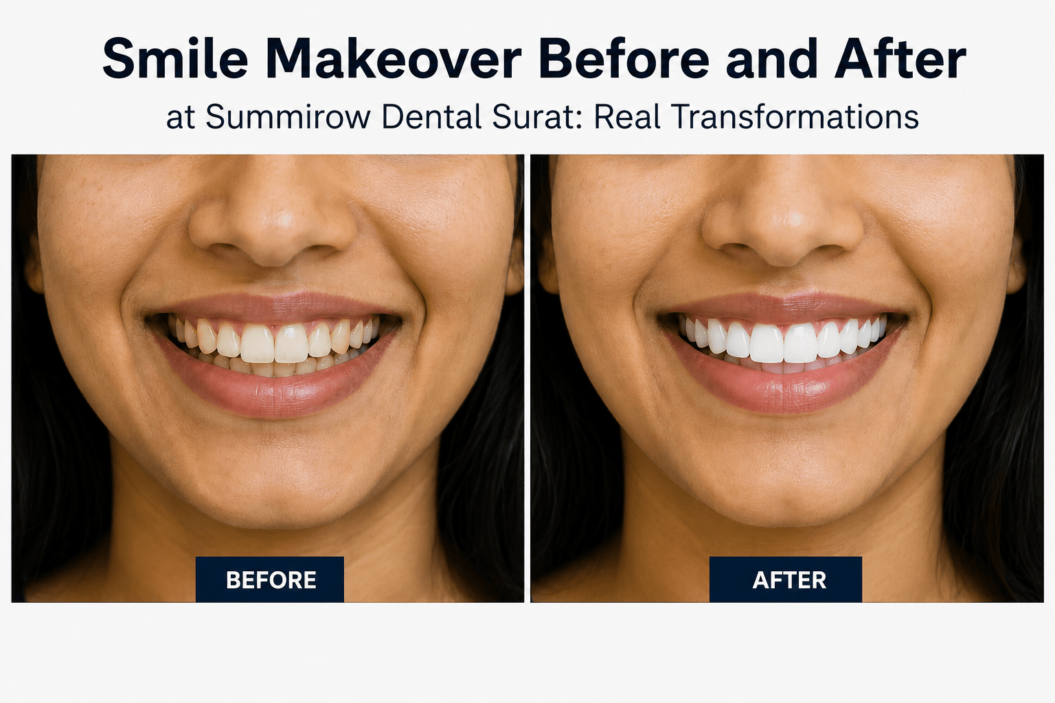 smile makeover before after Surat