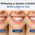 teeth whitening vs veneers Surat