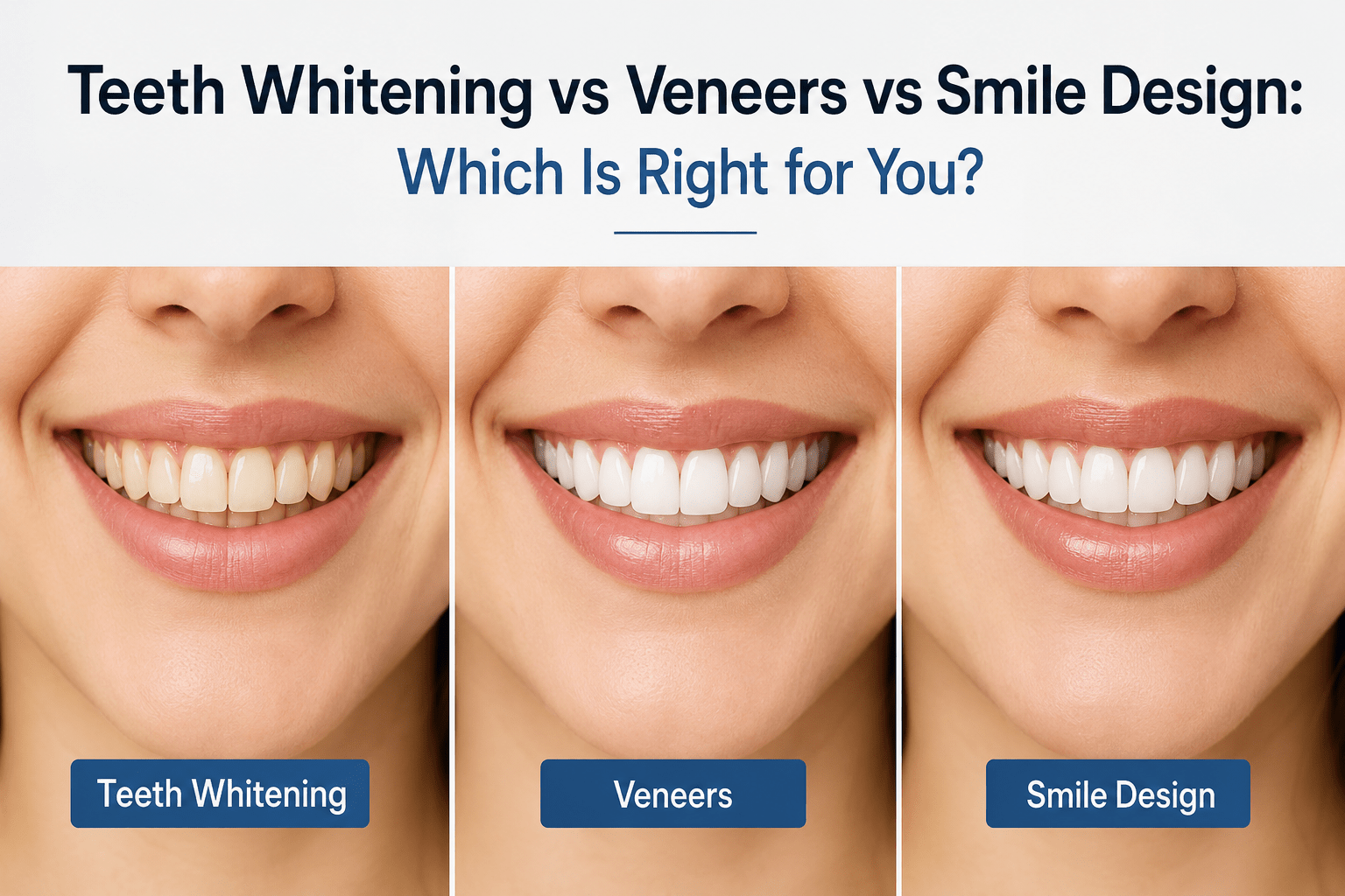 teeth whitening vs veneers Surat