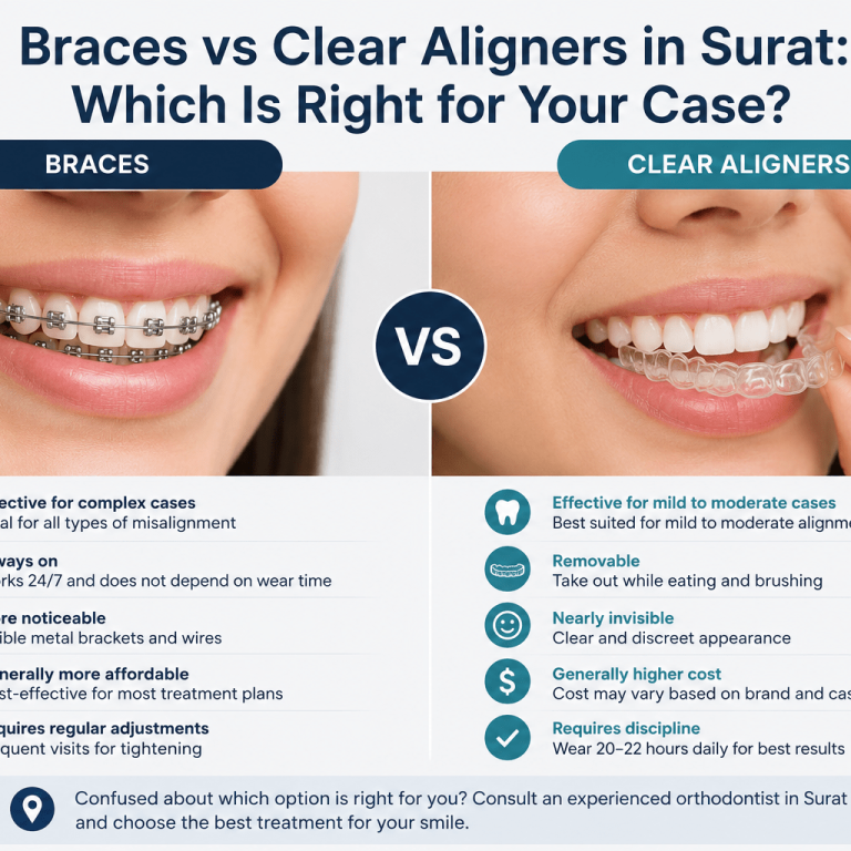braces vs clear aligners Surat