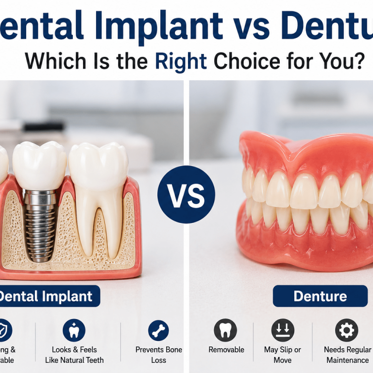 dental implant vs denture Surat