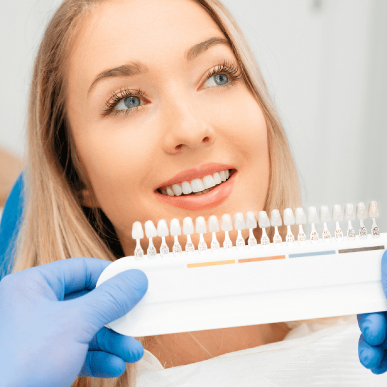 dental veneers cost Surat