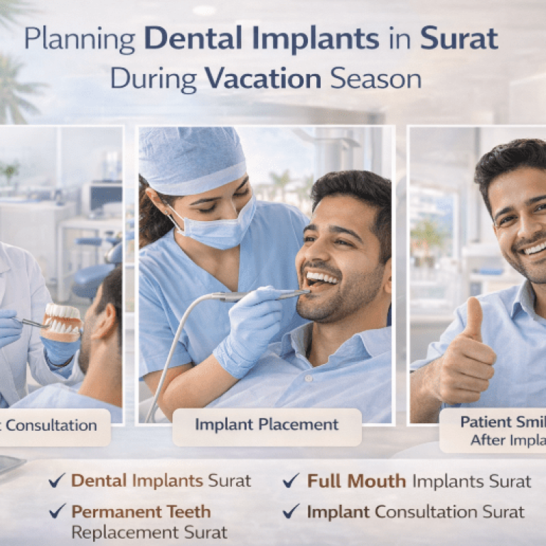 full mouth implants Surat
