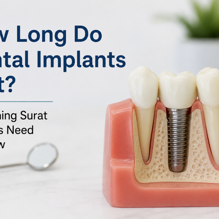 how long do dental implants last Surat