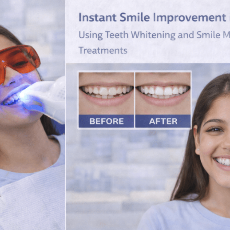 instant smile improvement Surat